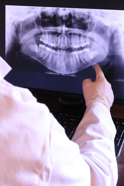 Best Emergency Treatment for Dental Infections or Abscesses in Gunnison, UT